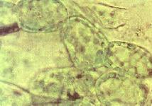cel_chlo.jpg (8603 octets)